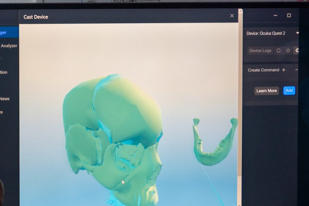 SkeleView: el prototipo de aplicación desarrollado por estudiantes de ICCI para facilitar el aprendizaje de la anatomía del cráneo y cuello mediante realidad mixta